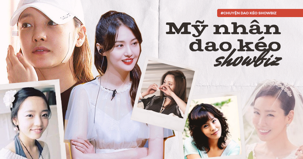 Tréo ngoe đời tư mỹ nhân dao kéo showbiz: Goo Hara - Trịnh Sảng xinh đẹp hoàn hảo lại không bằng loạt sao thẩm mỹ hỏng