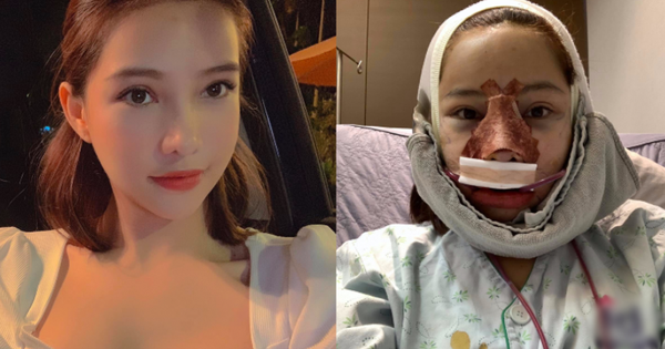 Lưu Đê Ly khoe trải qua 6 ca phẫu thuật ở Hàn để 'đập mặt làm lại', đẹp hay không chưa bàn chỉ biết là quá dũng cảm rồi!