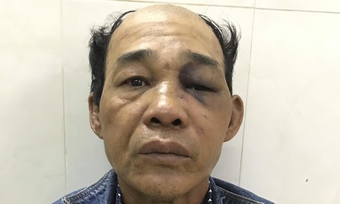 Kẻ lừa đảo chiếm đoạt hàng loạt xe máy ở Sài Gòn sa lưới