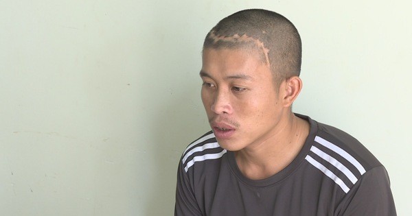 Bắt tên cướp kéo lê làm gãy tay nạn nhân trên đường